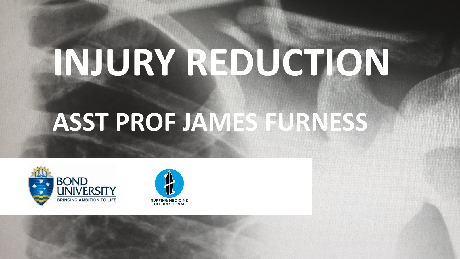 Injury Reduction for Surfers